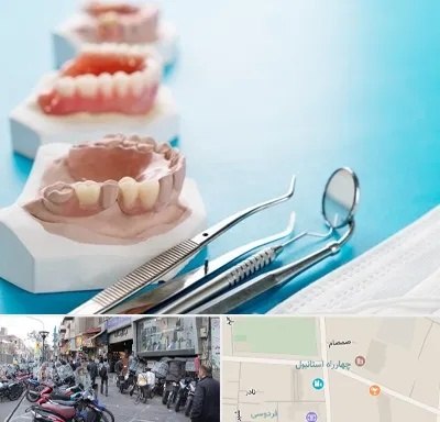 متخصص روکش دندان در چهارراه استانبول
