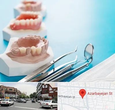 متخصص روکش دندان در خیابان آذربایجان