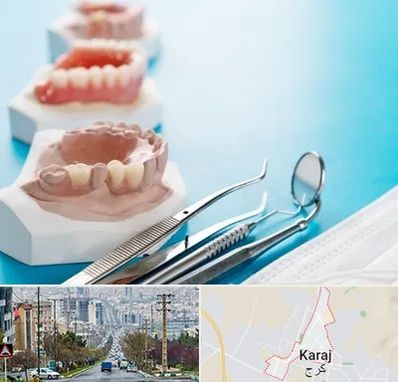 متخصص روکش دندان در گوهردشت کرج 