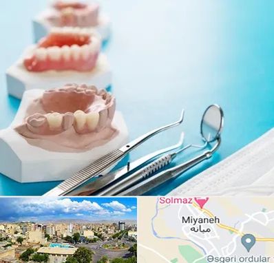 متخصص روکش دندان در میانه
