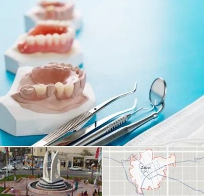 متخصص روکش دندان در زابل