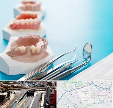 متخصص روکش دندان در ستارخان شیراز 