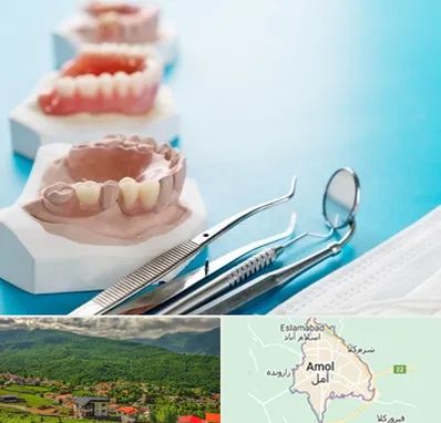متخصص روکش دندان در آمل