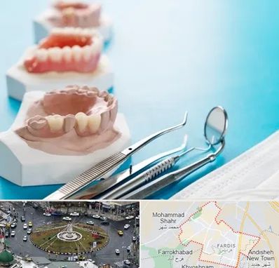 متخصص روکش دندان در فردیس کرج 