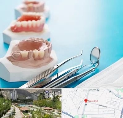 متخصص روکش دندان در بلوار تعاون