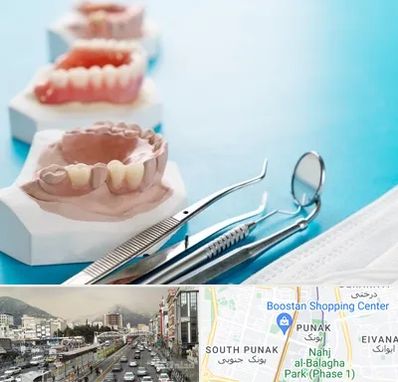 متخصص روکش دندان در پونک 