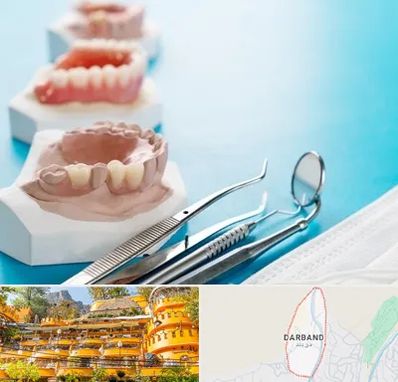 متخصص روکش دندان در دربند