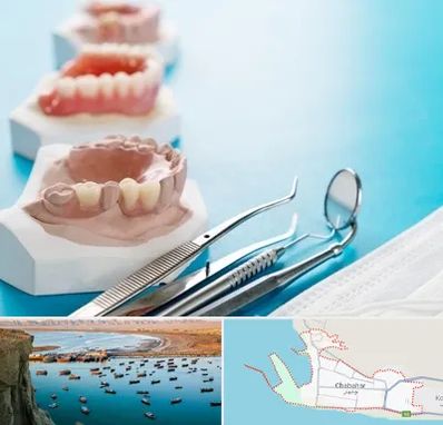 متخصص روکش دندان در چابهار