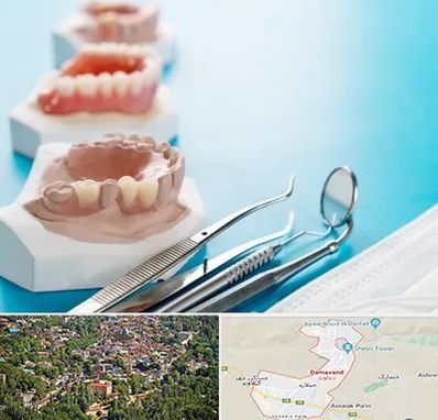 متخصص روکش دندان در دماوند