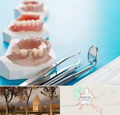 متخصص روکش دندان در تویسرکان