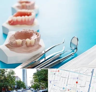 متخصص روکش دندان در امامت مشهد 