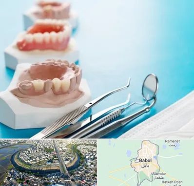 متخصص روکش دندان در بابل