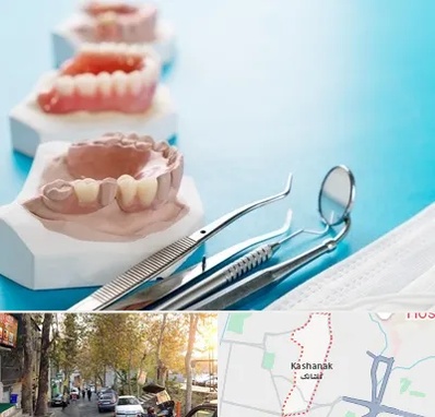 متخصص روکش دندان در کاشانک