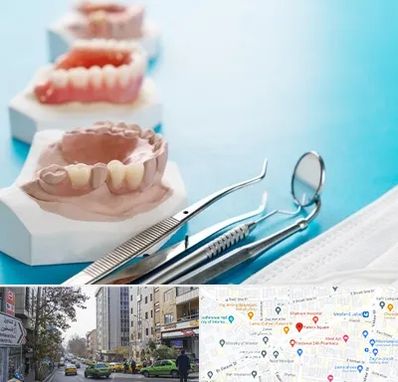 متخصص روکش دندان در فاطمی 