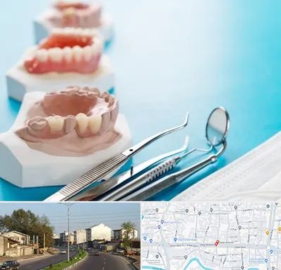 متخصص روکش دندان در ضیابری رشت 