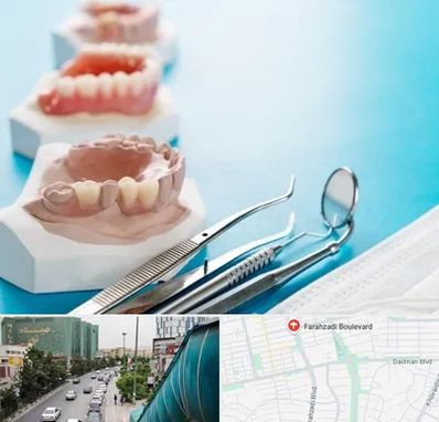 متخصص روکش دندان در بلوار فرحزادی