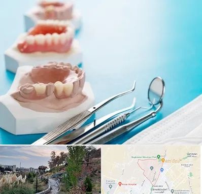 متخصص روکش دندان در باغستان کرج 