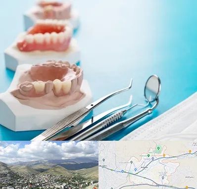 متخصص روکش دندان در رودهن