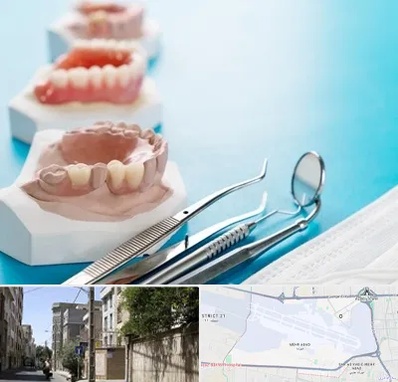 متخصص روکش دندان در مهرآباد