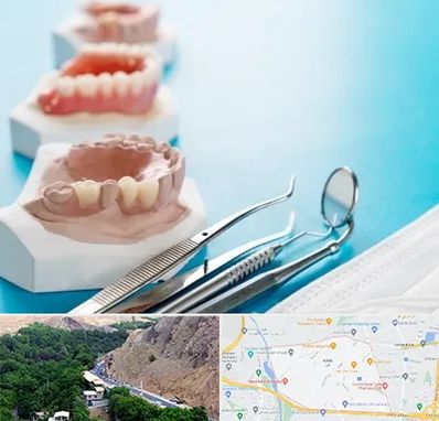 متخصص روکش دندان در کن 