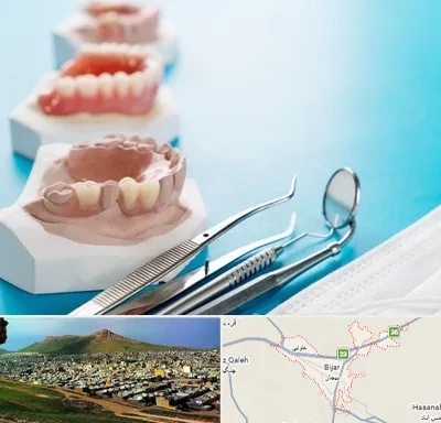 متخصص روکش دندان در بیجار