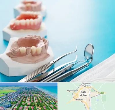 متخصص روکش دندان در ساری