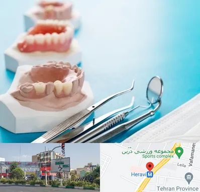 متخصص روکش دندان در هروی 