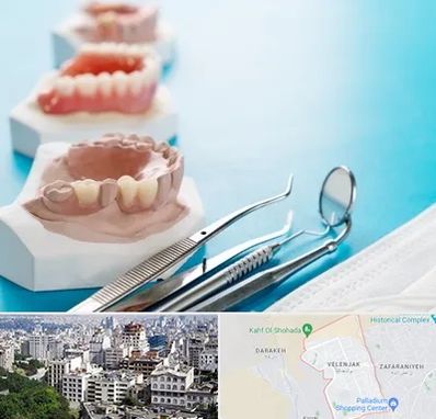 متخصص روکش دندان در ولنجک 