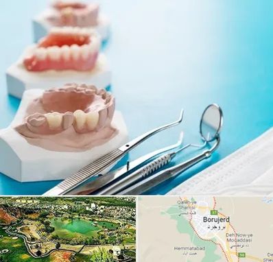 متخصص روکش دندان در بروجرد