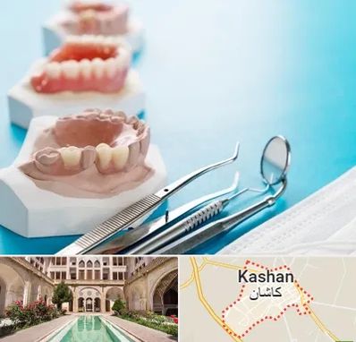 متخصص روکش دندان در کاشان