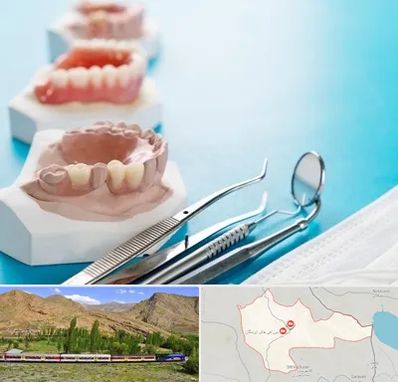 متخصص روکش دندان در خاش