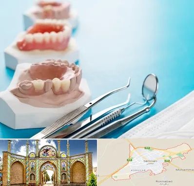 متخصص روکش دندان در سمنان