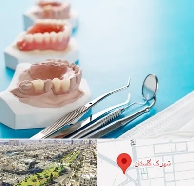 متخصص روکش دندان در شهرک گلستان