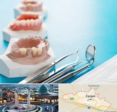 متخصص روکش دندان در زنجان