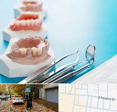 متخصص روکش دندان در خیابان فلسطین