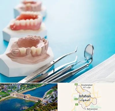 متخصص روکش دندان در اصفهان