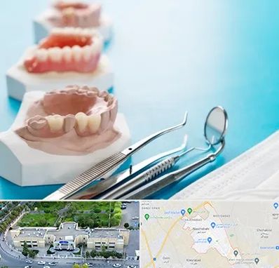 متخصص روکش دندان در نسیم شهر