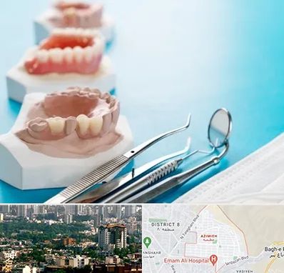 متخصص روکش دندان در عظیمیه کرج 