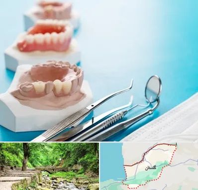 متخصص روکش دندان در گلستان