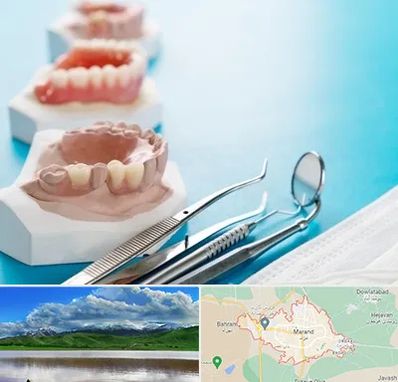 متخصص روکش دندان در مرند