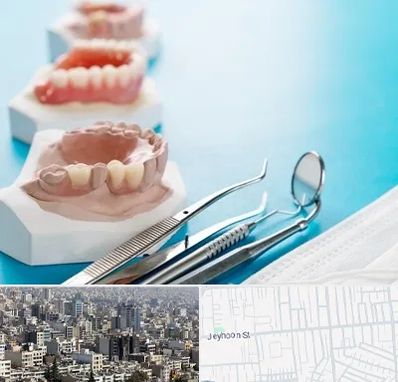 متخصص روکش دندان در جیحون