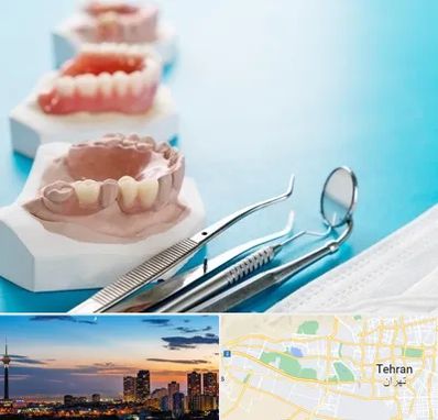 متخصص روکش دندان در غرب تهران 