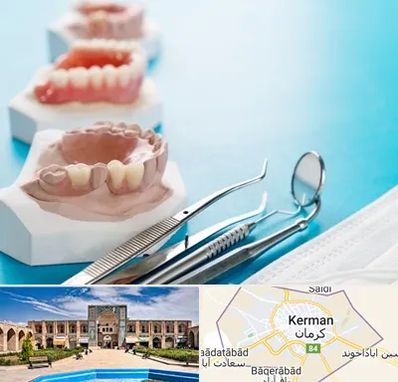 متخصص روکش دندان در کرمان