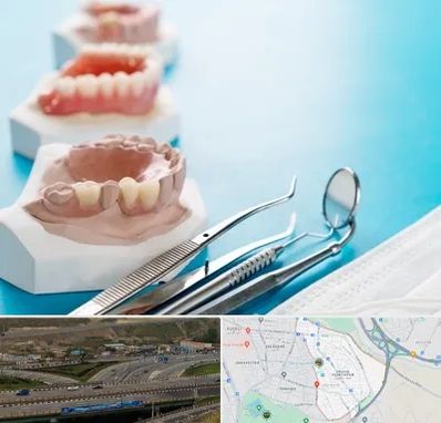 متخصص روکش دندان در یاغچیان تبریز