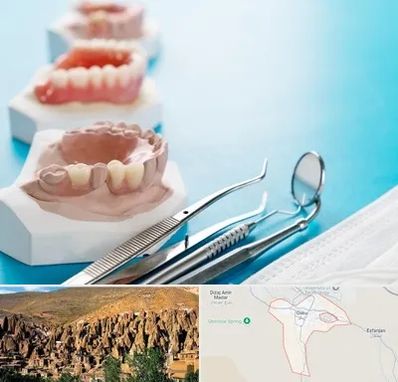 متخصص روکش دندان در اسکو