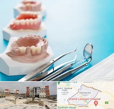 متخصص روکش دندان در حکیمیه 