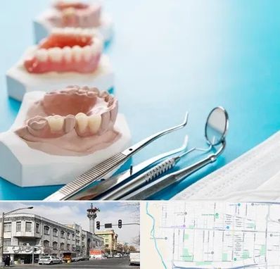 متخصص روکش دندان در 17شهریور