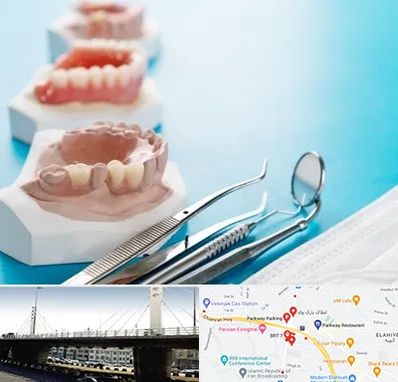 متخصص روکش دندان در پارک وی 