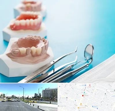 متخصص روکش دندان در بلوار کلاهدوز مشهد 