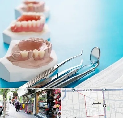 متخصص روکش دندان در سلسبیل